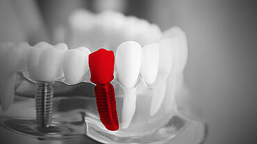ZwickRoell牙科行业测试系统
